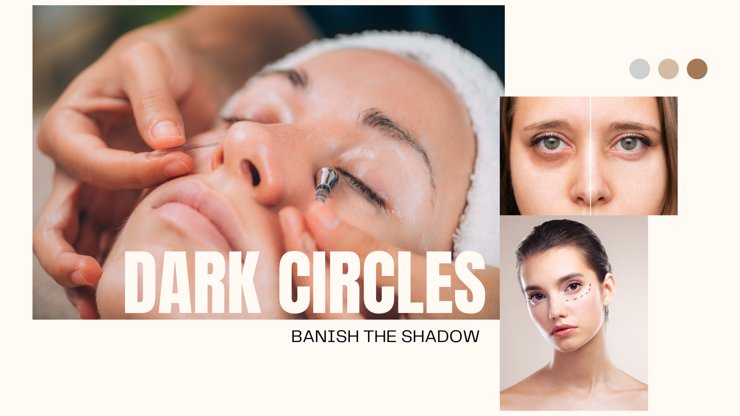 dark circles , causes of dark circles , genetics , hormonal, lack of sleep, screen time , deffieciency, tips to reduce dark circles , pigmentation , skin health , lifestyle