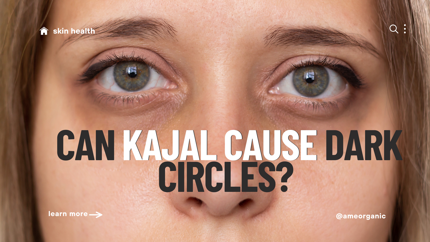 dark circles , kajol causing dark circles, lack of sleep , circardian rythm, under eye, pigmetation , dark under eye. solution to under eye , dark circle problem