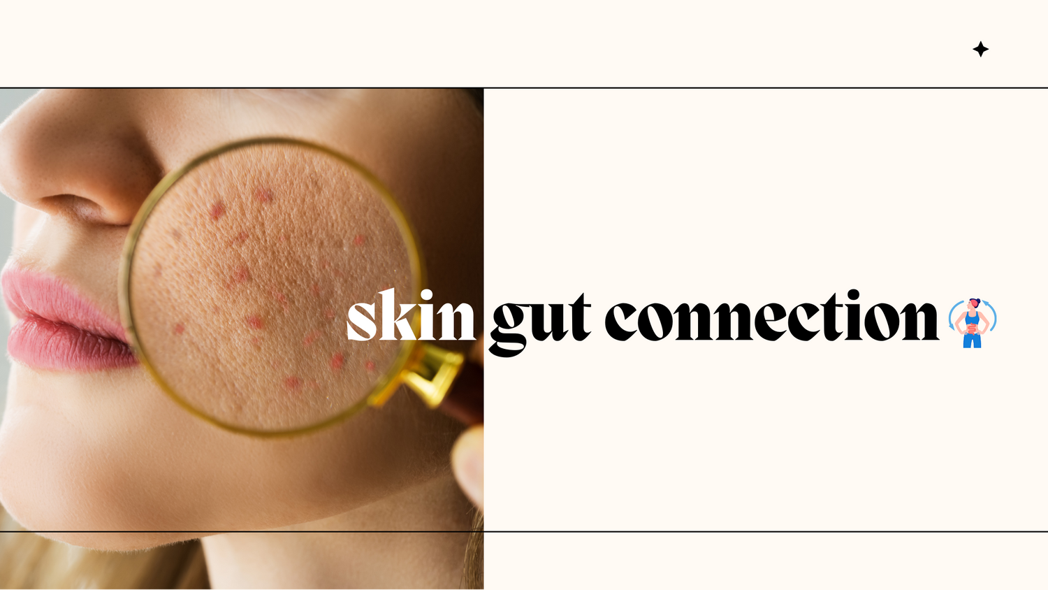 SKIN HEALTH, GUT HEALTH, ACNE , pimples ,skin - gut health