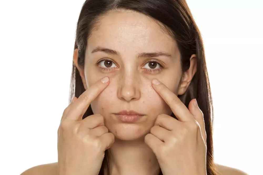 how to treat dark circles