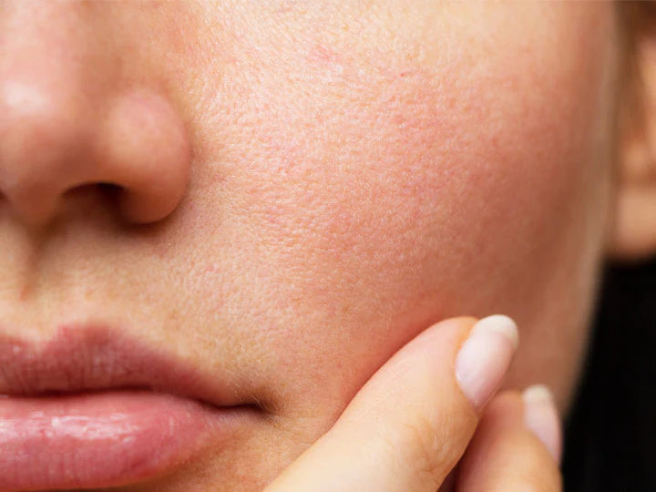 How to remove pores from face naturally