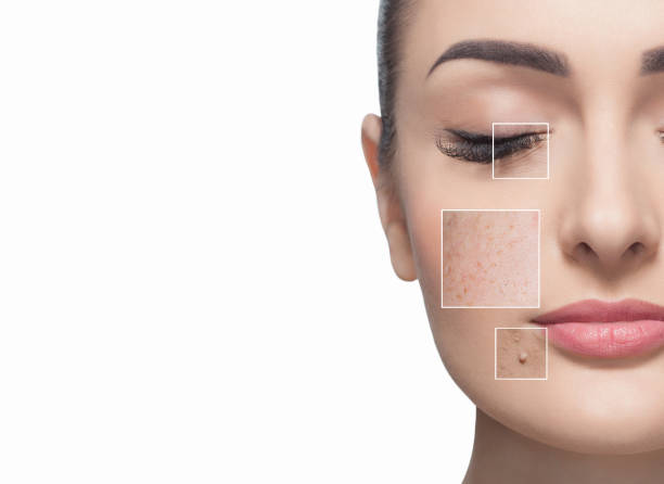 how to treat dark spots on  face