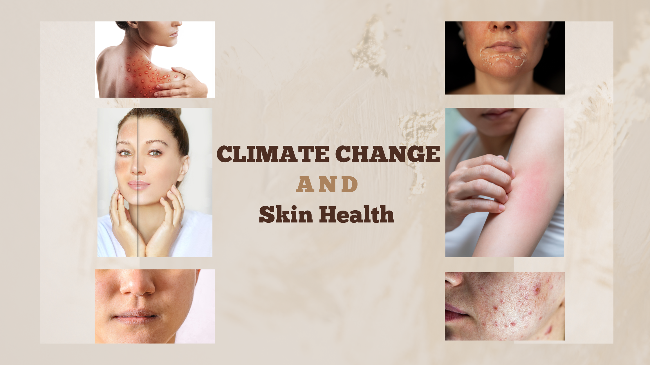 climate change , skin dryness, oily skin , acne . pimples, rashes, inflammation, redness, ski health 