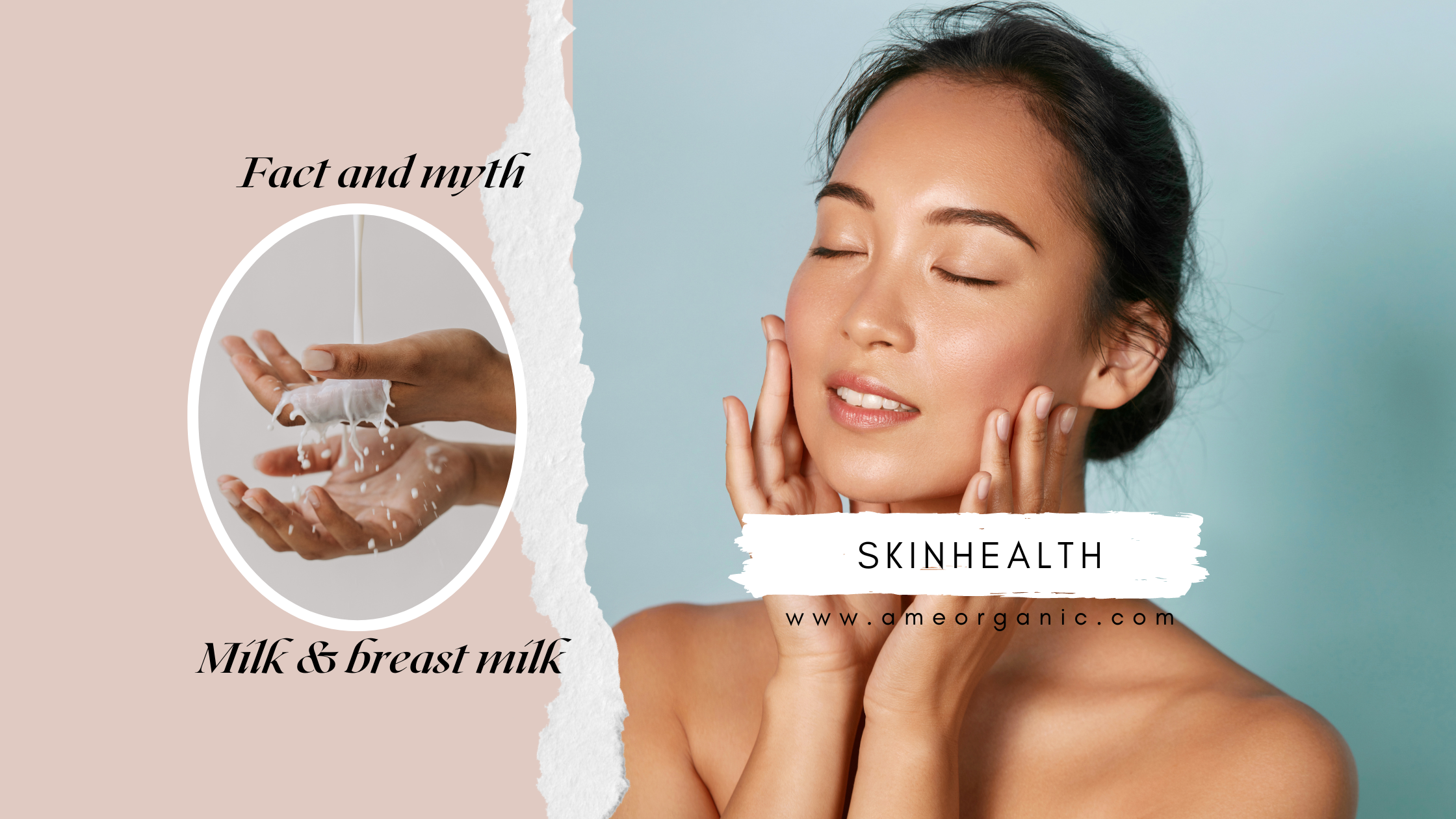 breast milk and skin care , suring skin problem , lactic acid, skin protection , vitamin A vitamin D, benefits of lactic acid , skin health ,