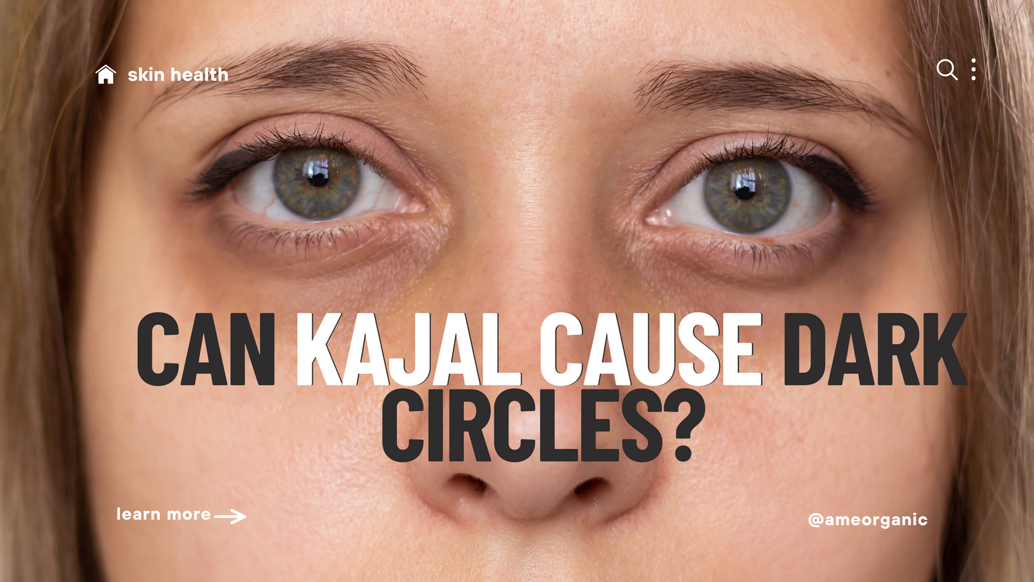 dark circles , kajol causing dark circles, lack of sleep , circardian rythm, under eye, pigmetation , dark under eye. solution to under eye , dark circle problem  