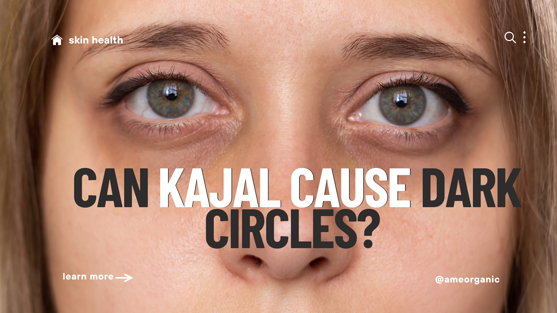 dark circles , kajol causing dark circles, lack of sleep , circardian rythm, under eye, pigmetation , dark under eye. solution to under eye , dark circle problem  