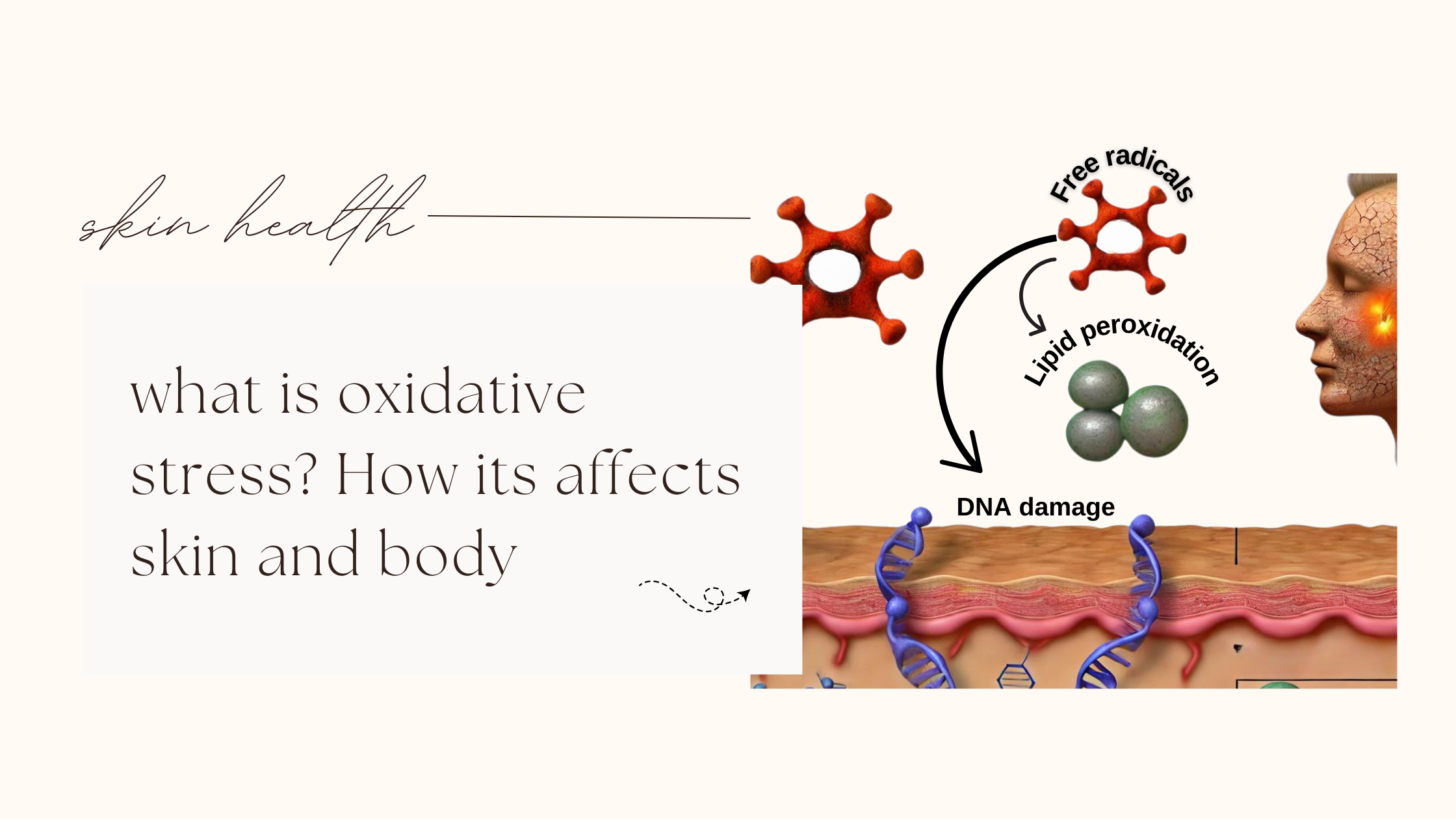 oxidative stress, free radicals, antioxidants, ros , environmental factors , inflamation , anti-aging , wrinkles , immune responses , cigarette moke , chemicals 