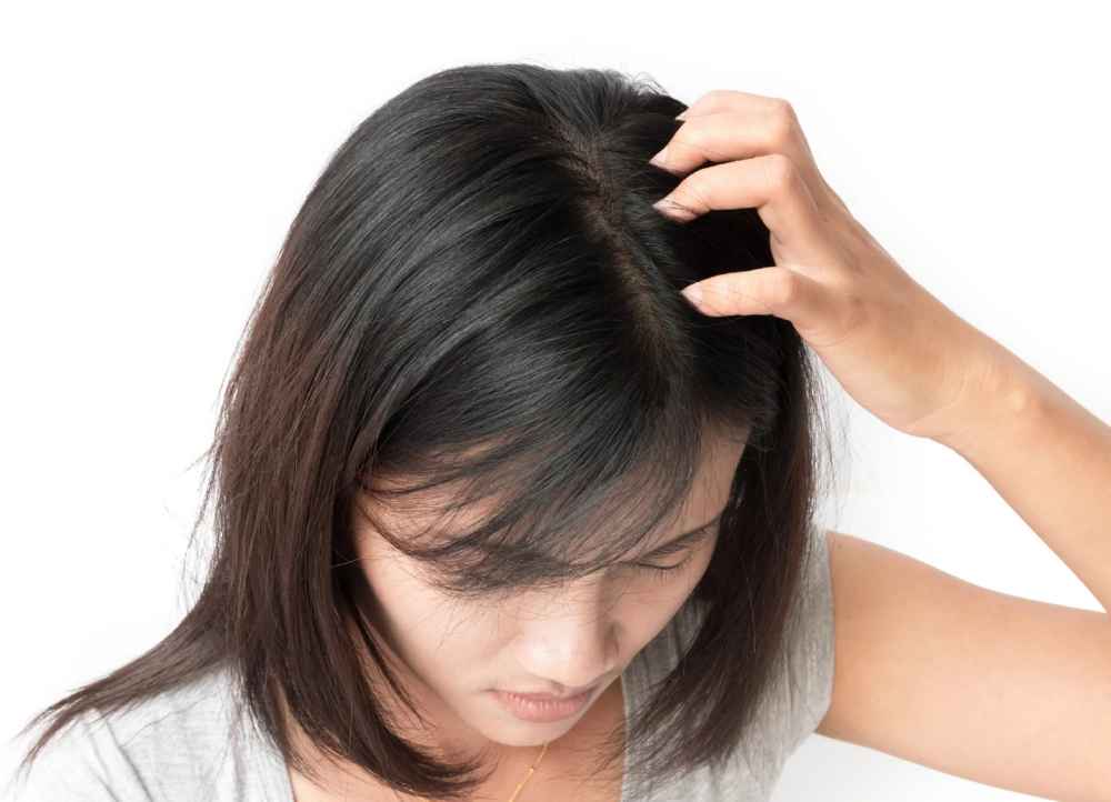 How to fight dry scalps?
