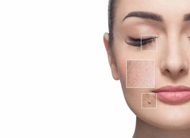 how to treat dark spots on  face 