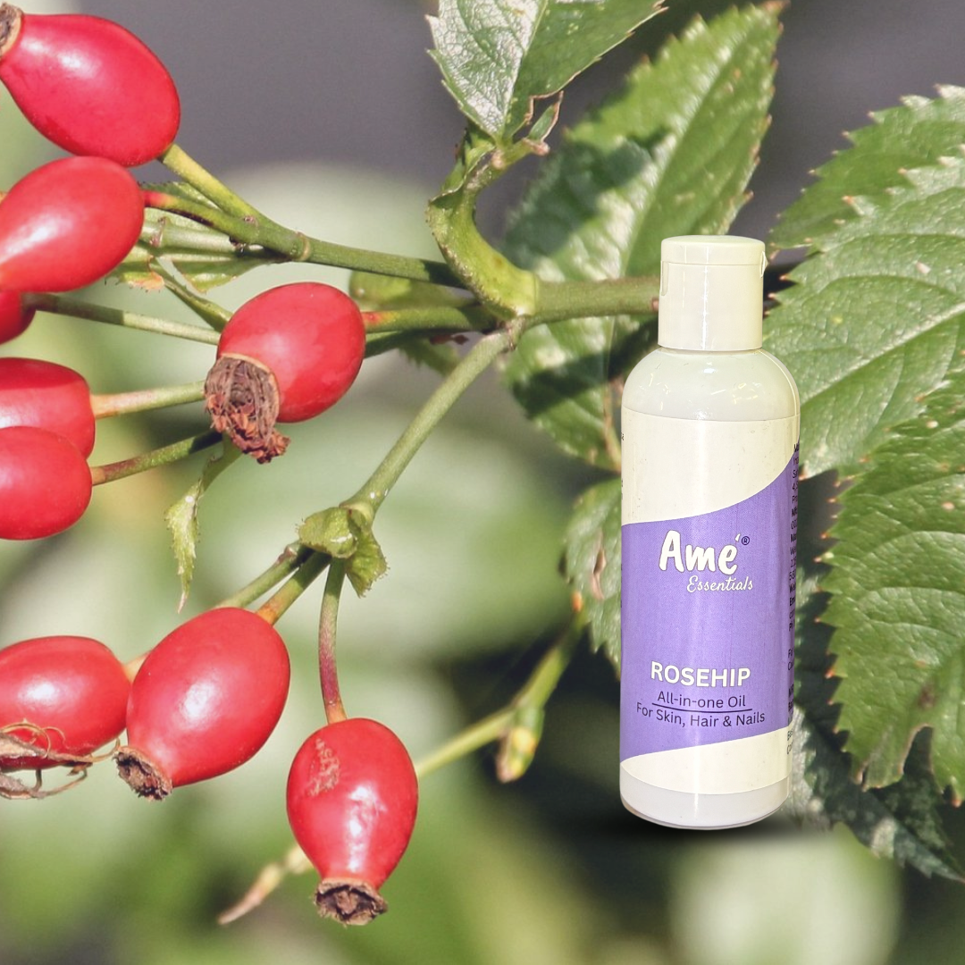 ROSEHIP OIL | RICH IN VITAMIN C | HAIR &amp; FACE OIL- 100ml