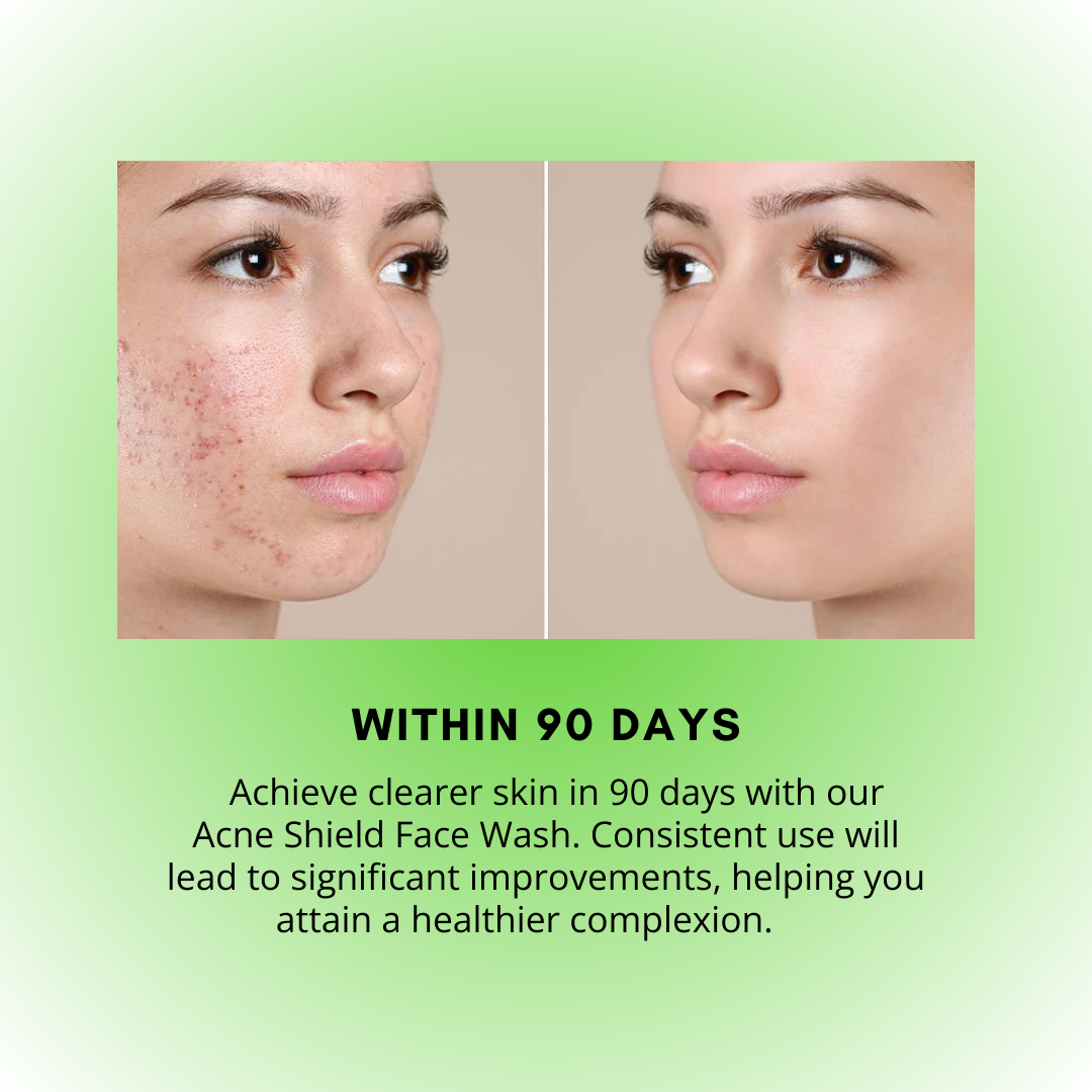 Acne Shield Face Wash – &quot;Tough on Acne, Gentle on Skin&quot;