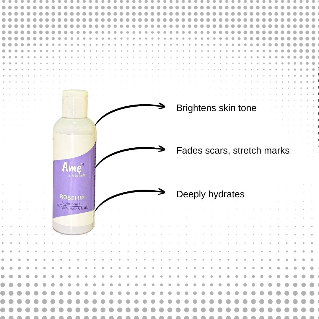 ROSEHIP OIL | RICH IN VITAMIN C | HAIR &amp; FACE OIL- 100ml